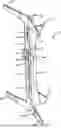 Fig. 01 - Climbing Stick