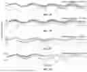 Fig. 08 - TRANSVERSE ALTERNATING CURRENT ELECTROPHORESIS SYSTEMS AND METHODS