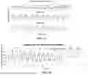 Fig. 23 - TRANSVERSE ALTERNATING CURRENT ELECTROPHORESIS SYSTEMS AND METHODS