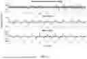 Fig. 24 - TRANSVERSE ALTERNATING CURRENT ELECTROPHORESIS SYSTEMS AND METHODS