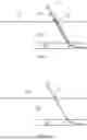 Fig. 08 - Vascular access line and implantation devices and methods