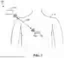 Fig. 02 - SYSTEMS FOR WIRELESSLY DELIVERING ENERGY TO IMPLANTED MEDICAL DEVICES AND ASSOCIATED METHODS