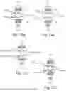 Fig. 10 - RESILIENT SLIP FRICTION JOINT