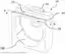 Fig. 01 - DEVICE FOR A LINEAR PERISTALTIC PUMP, ROTOR AND LINEAR PERISTALTIC PUMP