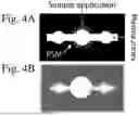 Fig. 08 - PATTERNED DRIED BLOOD SPOT CARDS AND RELATED ARTICLES AND METHODS