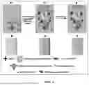 Fig. 02 - METHOD FOR LATERAL FLOW IMMUNOASSAY