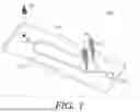Fig. 02 - MICRODEVICE FOR CELL SEPARATION UTILIZING ACTIVATION PHENOTYPE