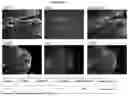 Fig. 07 - COMPOSITIONS AND METHODS FOR DETECTING PROTEASE ACTIVITY IN BIOLOGICAL SYSTEMS