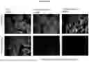 Fig. 08 - COMPOSITIONS AND METHODS FOR DETECTING PROTEASE ACTIVITY IN BIOLOGICAL SYSTEMS