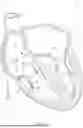 Fig. 02 - MINIMALLY-INVASIVE DEFECT CLOSURE