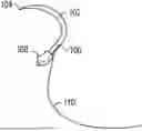 Fig. 01 - BIO-DISSOLVABLE SUTURING NEEDLE