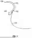 Fig. 02 - BIO-DISSOLVABLE SUTURING NEEDLE