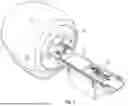 Fig. 02 - MRI COMPATIBLE STEERABLE SURGICAL APPARATUS AND METHOD