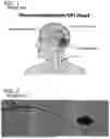 Fig. 02 - SYSTEMS AND METHODS FOR GUIDING SURGICAL TOOLS