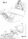 Fig. 08 - ACCESS DEVICE WITH ANCHORING BODY AND MODULAR INSERTS AND SUPPORT STRUCTURE FOR SUPPORTING ACCESSORIES USED IN MINIMALLY INVASIVE SURGICAL PROCEDURES