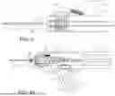 Fig. 08 - INTRAOSSEOUS DEVICE HAVING RETRACTABLE MOTOR/STYLET ASSEMBLY AND AUTOMATIC STYLET POINT COVER UPON RETRACTION OPERATION