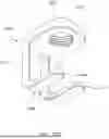 Fig. 63 - MINIMALLY INVASIVE SURGERY ADD ON SCREW SYSTEM