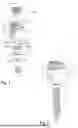 Fig. 02 - POLYAXIAL BONE ANCHORING DEVICE
