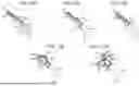 Fig. 09 - MULTI-MODAL CATHETER FOR IMPROVED ELECTRICAL MAPPING AND ABLATION