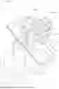 Fig. 03 - SURGERY ASSISTING DEVICE