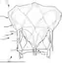 Fig. 01 - Heart Valve Replacement