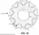Fig. 11 - Heart Valve Replacement