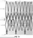 Fig. 14 - Heart Valve Replacement