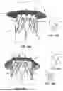 Fig. 17 - Heart Valve Replacement