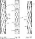 Fig. 03 - SYSTEMS, METHODS AND DEVICES FOR TREATING TRICUSPID INSUFFICIENCY