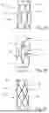 Fig. 04 - SYSTEMS, METHODS AND DEVICES FOR TREATING TRICUSPID INSUFFICIENCY