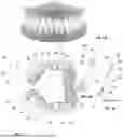 Fig. 02 - METHOD OF USE OF SNORING AND OBSTRUCTIVE SLEEP APNEA PREVENTION DEVICE