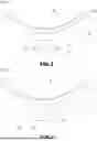 Fig. 03 - Method for positioning an interpositional ophthalmological implant at a distance from the limbus