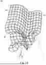 Fig. 79 - APPARATUSES AND METHODS FOR WOUND THERAPY