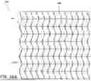Fig. 89 - APPARATUSES AND METHODS FOR WOUND THERAPY