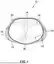 Fig. 05 - POSTPARTUM UNDERGARMENT APPARATUS