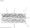 Fig. 04 - ACQUISITION AND DISTRIBUTION COMPOSITE, ABSORBENT HYGIENE ARTICLE AND METHOD OF PRODUCTION