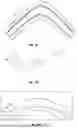 Fig. 08 - ELASTOMERIC INTENSIFIERS FOR PART MANUFACTURE AND METHODS OF MAKING ELASTOMERIC INTENSIFIERS