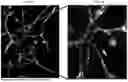 Fig. 09 - DEVICES, SYSTEMS AND METHODS FOR INHIBITING INVASION AND METASTASES OF CANCER