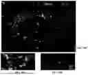 Fig. 15 - DEVICES, SYSTEMS AND METHODS FOR INHIBITING INVASION AND METASTASES OF CANCER