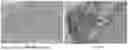 Fig. 16 - DEVICES, SYSTEMS AND METHODS FOR INHIBITING INVASION AND METASTASES OF CANCER