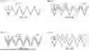 Fig. 04 - Diagnostics of outdoor unit of HVAC system based on sound signatures