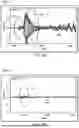 Fig. 06 - Diagnostics of outdoor unit of HVAC system based on sound signatures