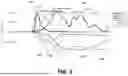 Fig. 06 - HEARING AID WITH COGNITIVE ADAPTATION AND METHODS THEREOF