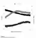 Fig. 02 - Process for Producing a Blank for Dental Restorations by Way of a Multi-Step Sedimentation Process