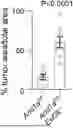 Fig. 01 - METHODS OF TREATING SWI/SNF DEREGULATED CANCERS