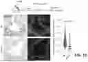 Fig. 06 - METHODS OF TREATING SWI/SNF DEREGULATED CANCERS