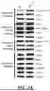 Fig. 12 - METHODS OF TREATING SWI/SNF DEREGULATED CANCERS
