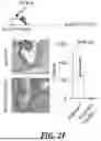 Fig. 17 - METHODS OF TREATING SWI/SNF DEREGULATED CANCERS