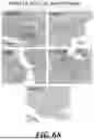 Fig. 53 - METHODS OF TREATING SWI/SNF DEREGULATED CANCERS