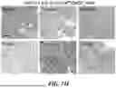 Fig. 59 - METHODS OF TREATING SWI/SNF DEREGULATED CANCERS